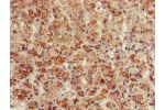 Immunohistochemistry of paraffin-embedded human adrenal gland tissue using CSB-PA002532LA01HU at dilution of 1:100