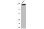 Western Blot analysis of HeLa cells using Filamin 1 Polyclonal Antibody