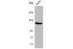 Western Blot analysis of HepG2 cells using Flg Polyclonal Antibody