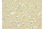 Immunohistochemistry of paraffin-embedded human brain tissue CSB-PA002541ESR1HU at dilution 1:100