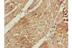 Immunohistochemistry of paraffin-embedded human heart tissue using CSB-PA002550LA01HU at dilution of 1:100