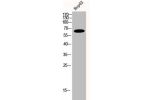 Western Blot analysis of HepG2 cells using FRS2 Polyclonal Antibody