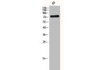 Western Blot analysis of KB cells using FSHR Polyclonal Antibody