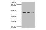 Western blot<br />
All lanes:Branched-chain-amino-acid aminotransferase, mitochondrial antibody at 2ug/ml<br />
Lane 1:NIH3T3 whole cell lysate<br />
Lane 2:mouse kidney tissue<br />
Lane 3:mouse spleen tissue<br />
Secondary<br />
Goat polyclonal to rabb