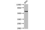 Western Blot<br />
Positive WB detected in:K562 whole cell lysate<br />
All lanes:BCHE antibody at 3