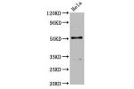 Western Blot<br />
Positive WB detected in:Hela whole cell lysate<br />
All lanes:BCKDHA antibody at 4.58