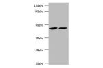 Western blot<br />
All lanes:BCKDK antibody at 5ug/ml<br />
Lane 1:293T whole cell lysate<br />
Lane 2:Hela whole cell lysate<br />
Secondary<br />
Goat polyclonal to rabbit at 1/10000 dilution<br />
Predicted band size: 47,38,42 kDa<br />
Observed band s