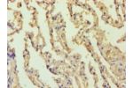 Immunohistochemistry of paraffin-embedded human lung tissue using CSB-PA002608HA01HU at dilution 1:100