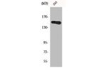 Western Blot analysis of 293 cells using GAK Polyclonal Antibody