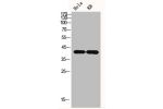 Western Blot analysis of HELA KB cells using GAP-43 Polyclonal Antibody