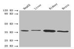 Western blot<br />
All lanes: BDH1 antibody at 2.4 ug/ml<br />
Lane 1 : HepG-2 whole cell lysate<br />
Lane 2 : Mouse liver tissue<br />
Lane 3 : Mouse kidney tissue<br />
Lane 4 : Mouse brain tissue<br />
Secondary<br />
Goat polyclonal to rabbit IgG at 