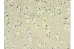 Immunohistochemistry of paraffin-embedded human brain tissue using CSB-PA002655LA01HU at dilution 1:100
