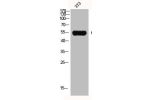 Western Blot analysis of NIH-3T3 cells using GCK Polyclonal Antibody