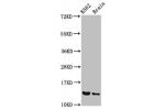 Western Blot<br />
Positive WB detected in:K562 whole cell lysate,Rat brain tissue<br />
All lanes:BET1 antibody at 3.4