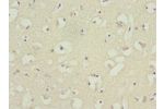 Immunohistochemistry of paraffin-embedded human brain tissue using CSB-PA002678ESR1HU at dilution 1:100