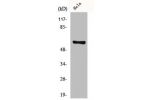 Western Blot analysis of Jurkat cells using GK2 Polyclonal Antibody