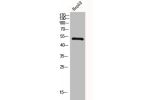 Western Blot analysis of HepG2 cells using GLP-1R Polyclonal Antibody