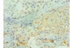 Immunohistochemistry of paraffin-embedded human testicle using CSB-PA002700ESR1HU at dilution 1:100