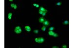 Immunofluorescence staining of HepG2 cells with CSB-PA002701LA01HU at 1:33,counter-stained with DAPI. The cells were fixed in 4% formaldehyde, permeabilized using 0.2% Triton X-100 and blocked in 10% normal Goat Serum. The cells were then incubated with t