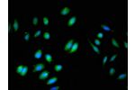 Immunofluorescent analysis of A549 cells using CSB-PA002702LA01HU at a dilution of 1:100 and Alexa Fluor 488-congugated AffiniPure Goat Anti-Rabbit IgG(H+L)