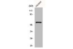 Western Blot analysis of COLO205 cells using Glucagon Receptor Polyclonal Antibody
