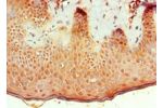 Immunohistochemistry of paraffin-embedded human skin using CSB-PA002735ESR1HU at dilution 1:100