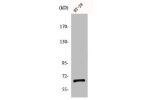 Western Blot analysis of HT29 cells using gp91-phox Polyclonal Antibody