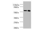All lanes:Bone morphogenetic protein 3 antibody at 2ug/ml<br />
Lane 1:SW1990 whole cell lysate<br />
Lane 2:293T whole cell lysate<br />
Secondary<br />
Goat polyclonal to rabbit at 1/10000 dilution<br />
Predicted band size: 53kDa<br />
Observed band si