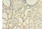 Immunohistochemistry of paraffin-embedded human kidney tissue using CSB-PA002748LA01HU at dilution 1:100
