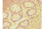 Immunohistochemistry of paraffin-embedded human rectum using CSB-PA002761ESR2HU at dilution 1:100