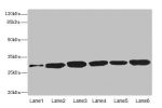 Western blot<br />
All lanes: BPGM antibody at 5.94ug/ml<br />
Lane 1 : Human peripheral blood mononuclear cells<br />
Lane 2 : Mouse liver tissue<br />
Lane 3 : Human placenta tissue<br />
Lane 4 : Hela whole cell lysate<br />
Lane 5 : 293T whole cell ly