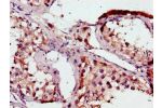 Immunohistochemistry of paraffin-embedded human testis tissue using CSB-PA002791LA01HU at dilution of 1:100