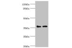 All lanes:Lys-63-specific deubiquitinase BRCC36 antibody at 3ug/ml<br />
Lane 1:293T whole cell lysate<br />
Lane 2:MCF-7 whole cell lysate<br />
Secondary<br />
Goat polyclonal to rabbit at 1/10000 dilution<br />
Predicted band size: 37,34,24,29 kDa<br /