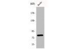 Western Blot analysis of HuvEc cells using GRK 2 Polyclonal Antibody