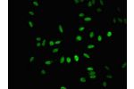 Immunofluorescent analysis of Hela cells using CSB-PA002839LA01HU at a dilution of 1:100 and Alexa Fluor 488-congugated AffiniPure Goat Anti-Rabbit IgG(H+L)