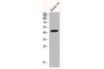Western Blot analysis of HEPG2-UV cells using Ga olf Polyclonal Antibody