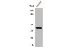 Western Blot analysis of COLO205 cells using Ga t1 Polyclonal Antibody