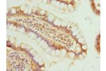 Immunohistochemistry of paraffin-embedded human small intestine tissue using CSB-PA002863ESR1HU at dilution 1:100