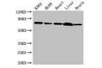 Western Blot<br />
Positive WB detected in:K562 whole cell lysate,HL60 whole cell lysate,Mouse heart tissue,Mouse liver tissue,Mouse brain tissue<br />
All lanes: BTK antibody at 3.5ug/ml<br />
Secondary<br />
Goat polyclonal to rabbit IgG at 1/50000 dilu