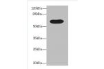 Western blot<br />
All lanes:BTN3A1 antibody at 12ug/ml+mouse liver tissue<br />
Secondary<br />
Goat polyclonal to rabbit at 1/10000 dilution<br />
Predicted band size: 58,40,42,53kDa<br />
Observed band size: 58 kDa<br />