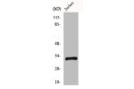 Western Blot analysis of COLO205 cells using HEI10 Polyclonal Antibody