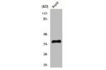 Western Blot analysis of Jurkat cells using Hel-N1 Polyclonal Antibody