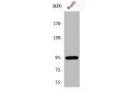 Western Blot analysis of HepG2 cells using HIF-1