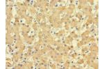Immunohistochemistry of paraffin-embedded human liver tissue using CSB-PA002922LA01HU at dilution 1:100
