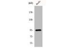 Western Blot analysis of A549 cells using HURP Polyclonal Antibody