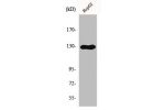 Western Blot analysis of HepG2 cells using IL-3R