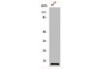Western Blot analysis of HeLa cells using IL-8 Polyclonal Antibody