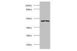 All lanes: Spliceosome RNA helicase DDX39B antibody at 2ug/ml<br />
Lane 1 : EC109 whole cell lysate<br />
Lane 2 : 293T whole cell lysate<br />
Secondary<br />
Goat polyclonal to Rabbit IgG at 1/15000 dilution<br />
Predicted band size: 49,51 kDa<br />
O