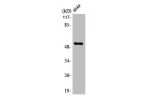 Western Blot analysis of LOVO cells using mAChR M4 Polyclonal Antibody