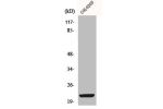 Western Blot analysis of COLO205 cells using ML-IAP Polyclonal Antibody
